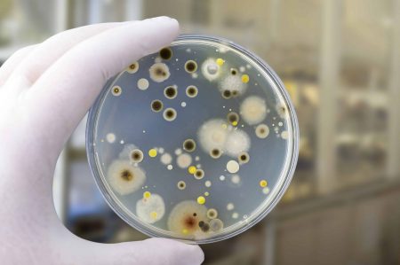 Canva-Colonies-of-different-bacteria-and-mold-fungi-grown-on-Petri-dish-with-nutrient-agar